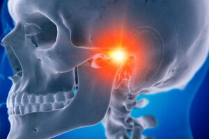 fisioterapia-disfuncao- temporomandibular-DTM-instituto-improve-fisioterapia-guarulhos